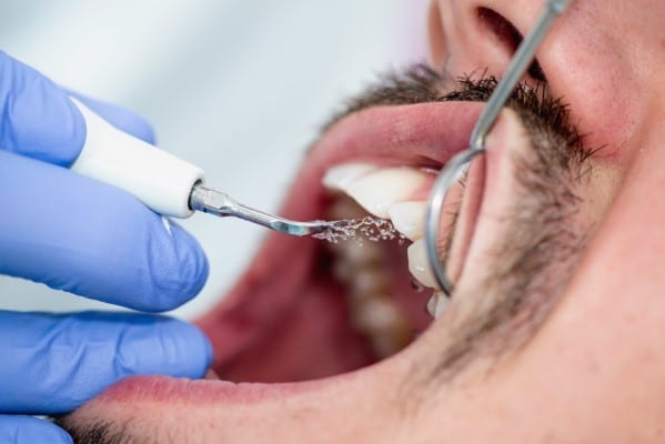 Plaque and Tartar: Don’t Make a Sticky Situation Harder