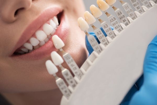 Custom-made, Same-Day Dental Restorations Offer Greater Convenience