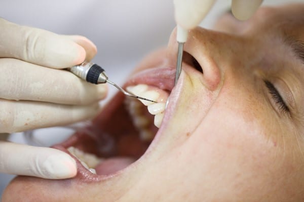 Receding Gums: Signs, Causes, and Solutions