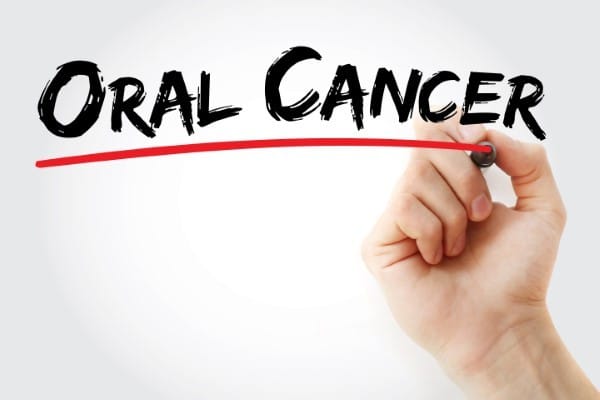 Oral Cancer: Hunting the Silent Killer