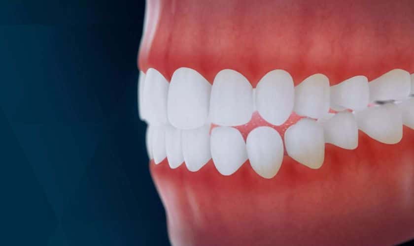 What are more dental-friendly alternatives to gum?