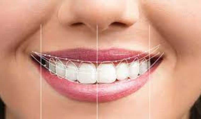 What Cosmetic Dentistry Treatments Should I Get for a Smile Makeover?