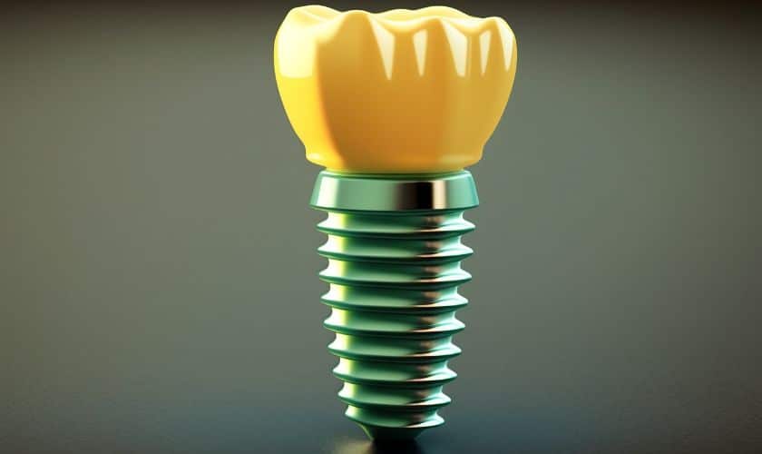 What Dental Implants Can Do For You