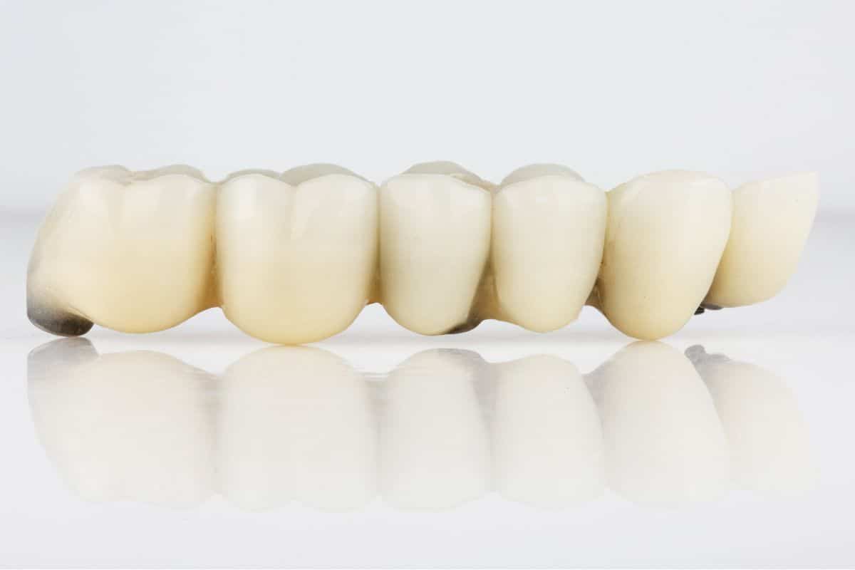 Crown in a Day: Why It Could Be the Right Choice for You