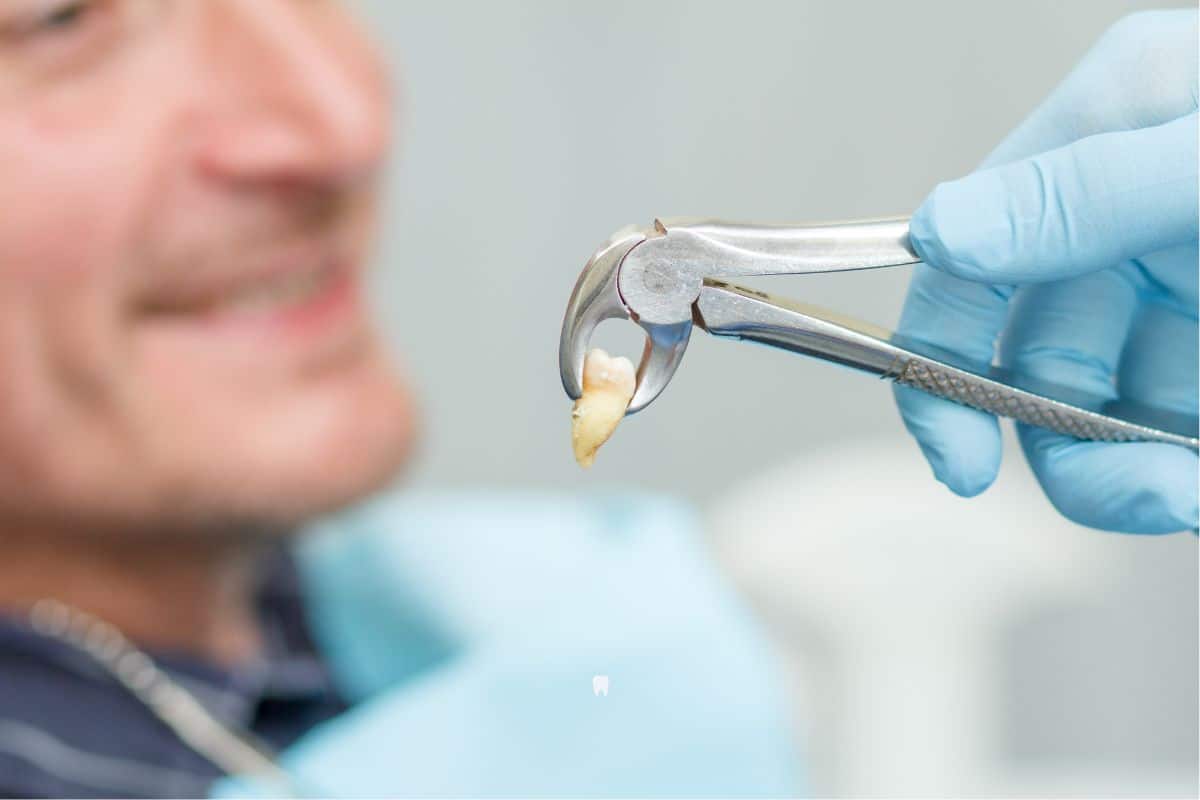 Aftercare for Tooth Extractions: Dos and Don’ts