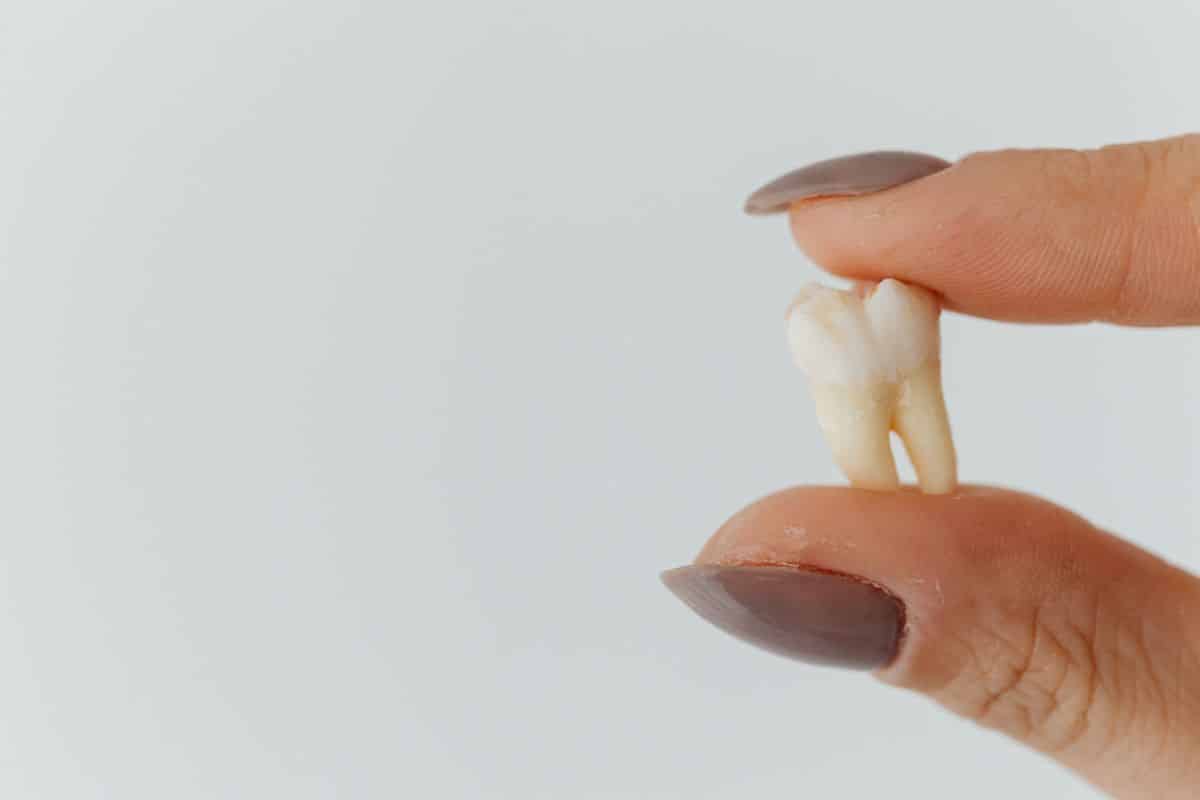 What Actions to Take If You Lose a Tooth?