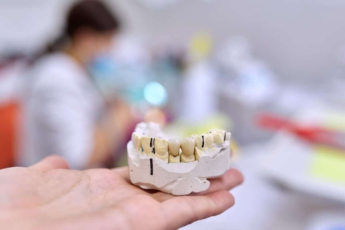 Can Ceramic Crowns Be Used for Front Teeth?