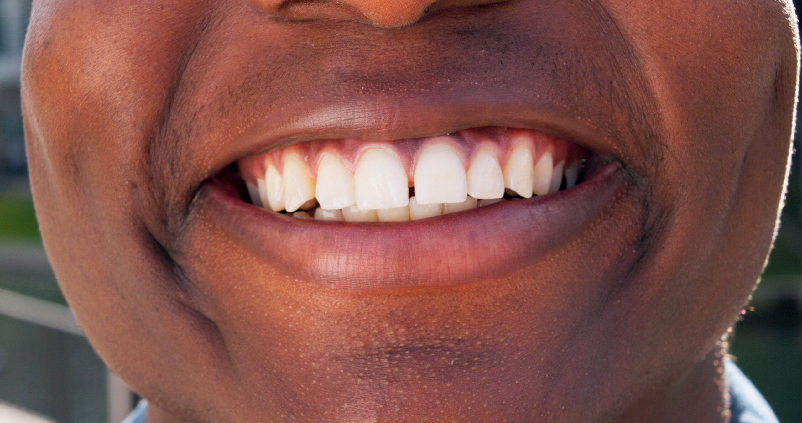 Beyond Age: Why More Mature Smiles in New Haven Are Choosing Cosmetic Dentistry