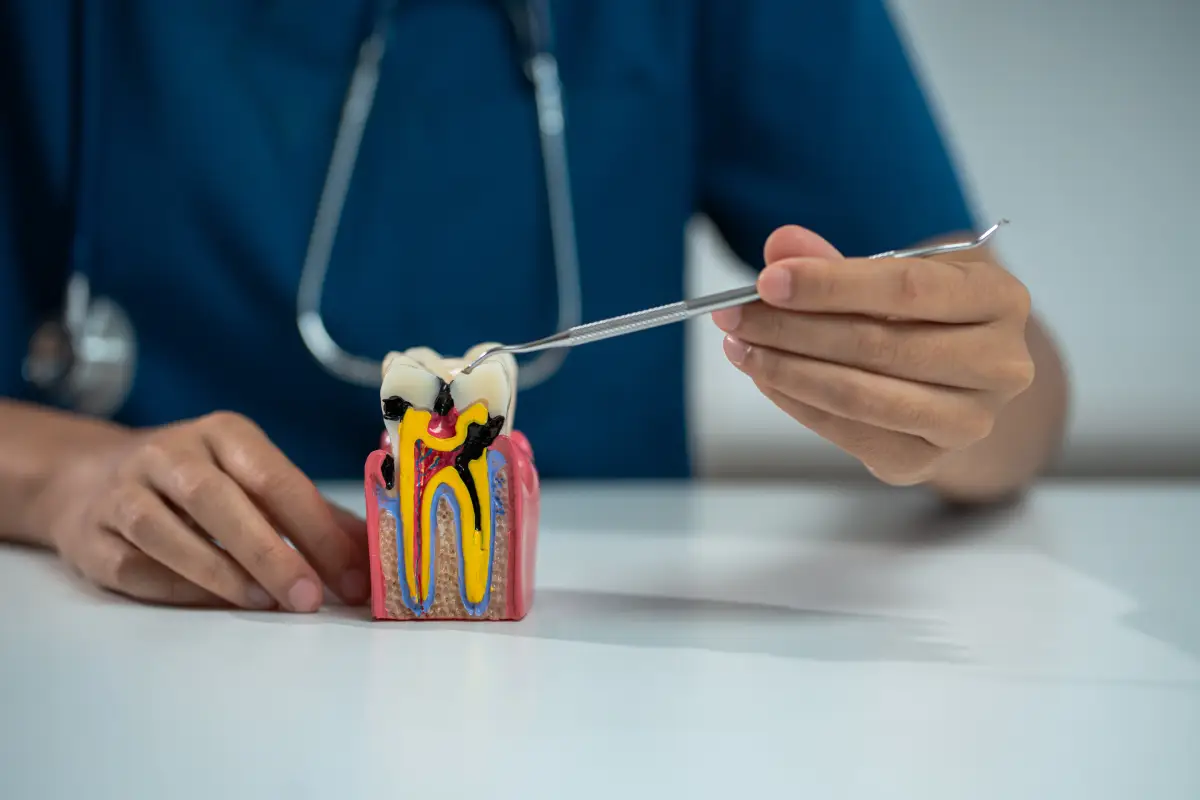 7 Signs You May Need a Root Canal